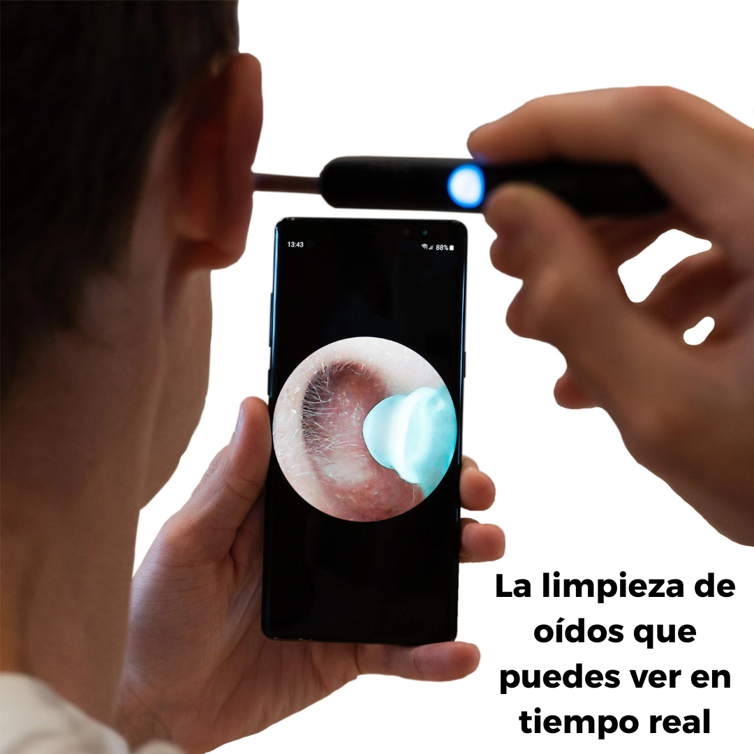 Limpieza de Oídos con Cámara HD - OtoView™ ORIGINAL ⭐️⭐️⭐️⭐️⭐️